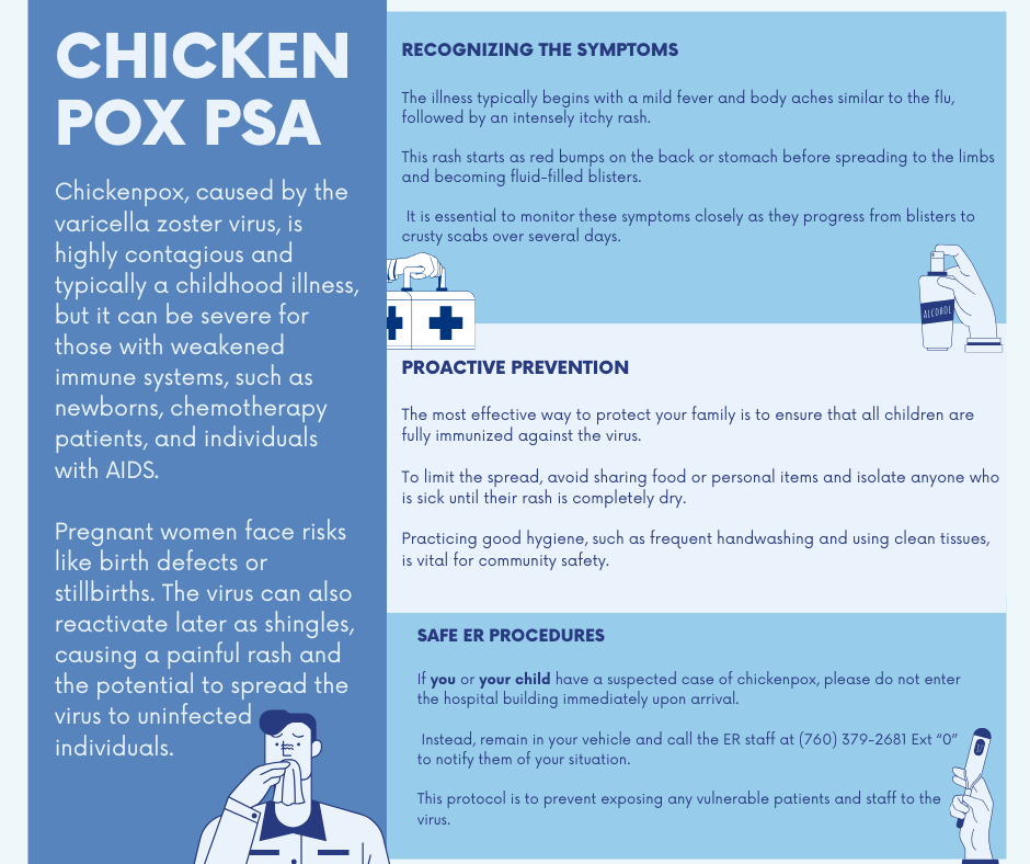 Chickenpox PSA Facebook Post at Kern Valley Health District
